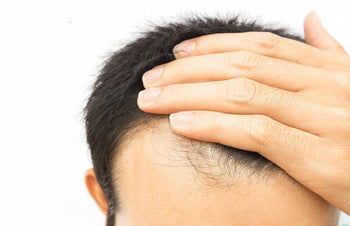 Early Signs of Balding: 10 Signs You're Starting To Lose Your Hair